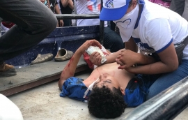 Nicaragua, la nueva matanza y la postura de la universidad jesuita
